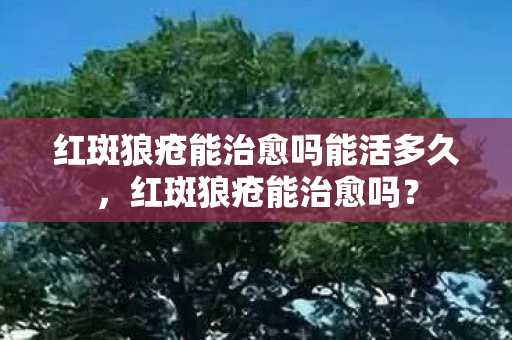 红斑狼疮能治愈吗能活多久,红斑狼疮能治愈吗? 红斑狼疮能治愈吗能活多久,红斑狼疮能治愈吗?