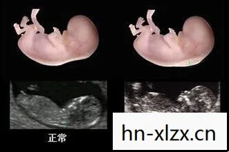 网络术语NT的多样含义解析图片